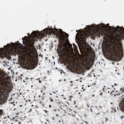 PHLPP Antibody, Novus Biologicals 0.1mL; Unlabeled:Antibodies, Polyclonal